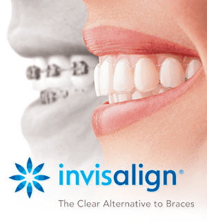 Image showing contract between metal Braces and Invisalign, a type of clear braces Austin residents choose.