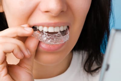 Smiling woman with perfect and healthy teeth using removable braces or aligner for straightening and whitening teeth. Orthodontic treatment for correction of bite