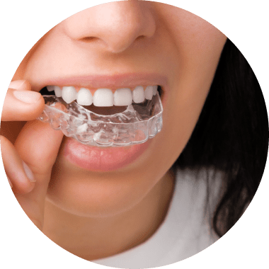 Orthodontic Treatment Options